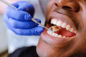 Teeth Cleaning Procedure