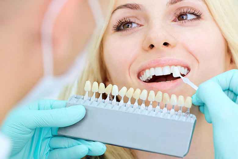 Teeth Filling Procedure