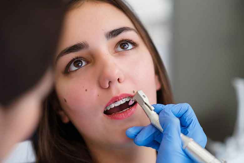 Teeth Cleaning Procedure