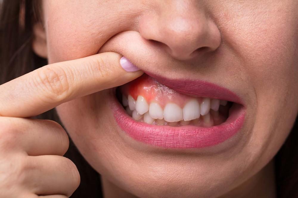 Girl Touching the Gums