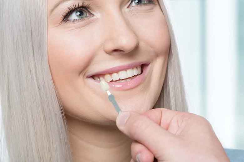 women smiling and matching the color of teeth