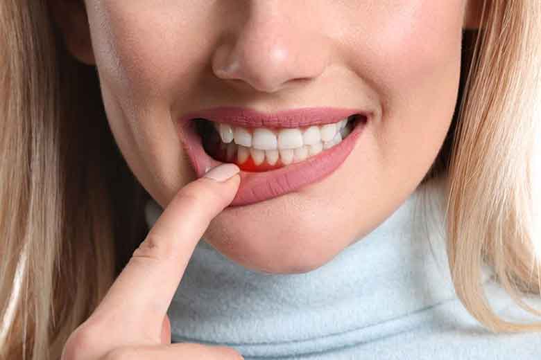 Teeth Shifting Procedure