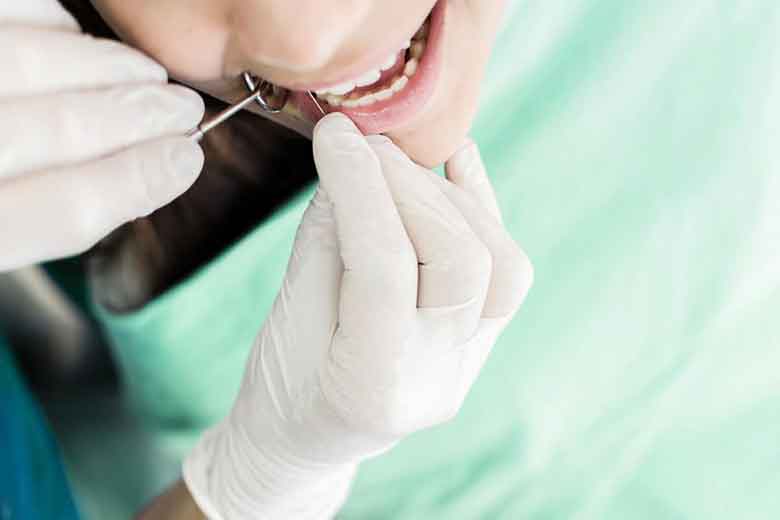 Teeth Cleaning Procedure