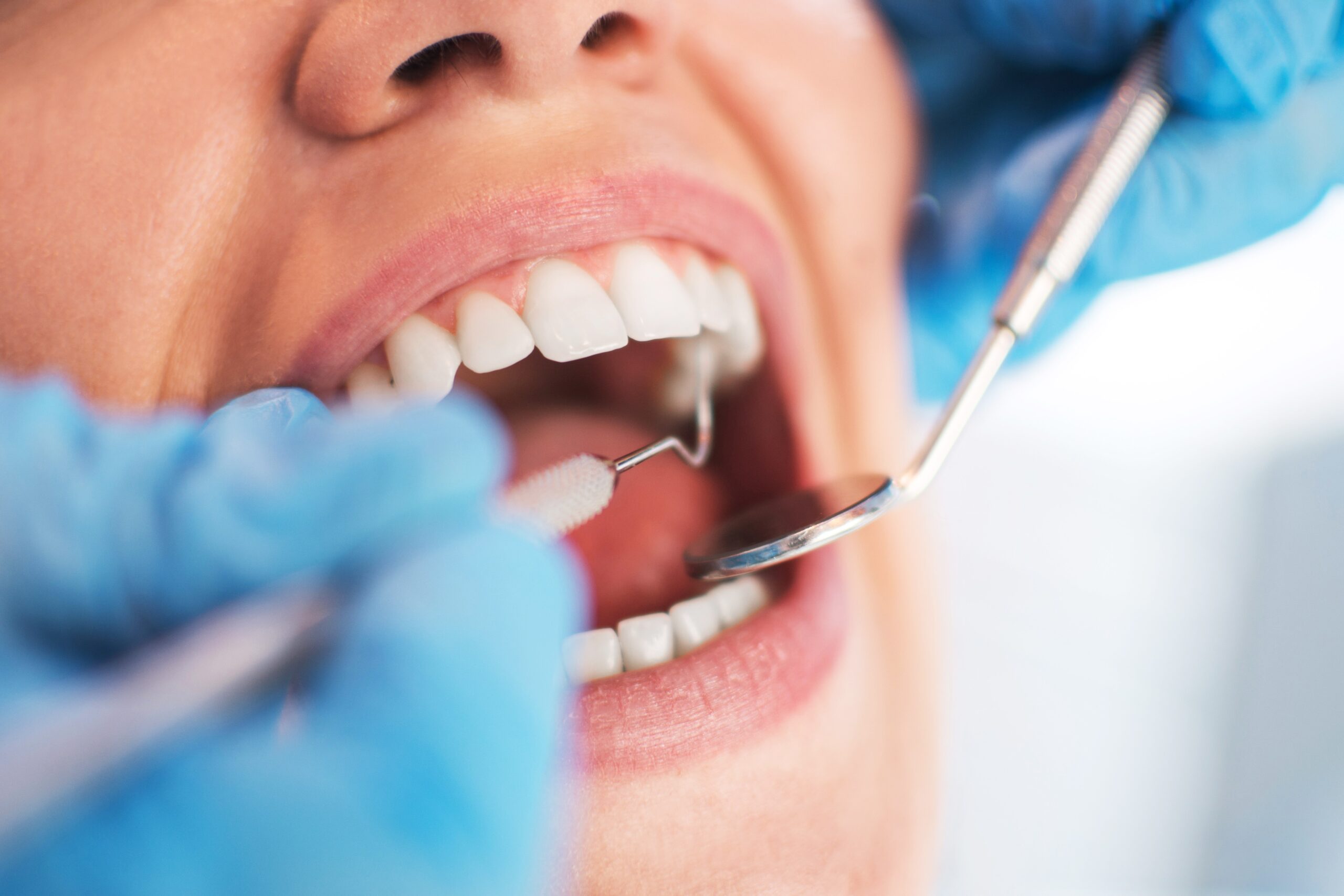 Oral Cancer Screenings