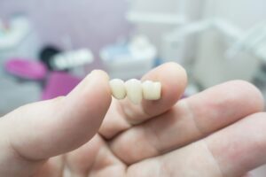 dental ceramic metal bridges in the hands of a doctor in Parker, CO