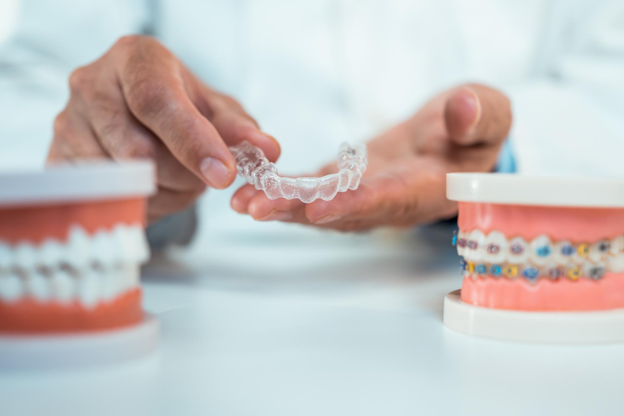 clear-braces