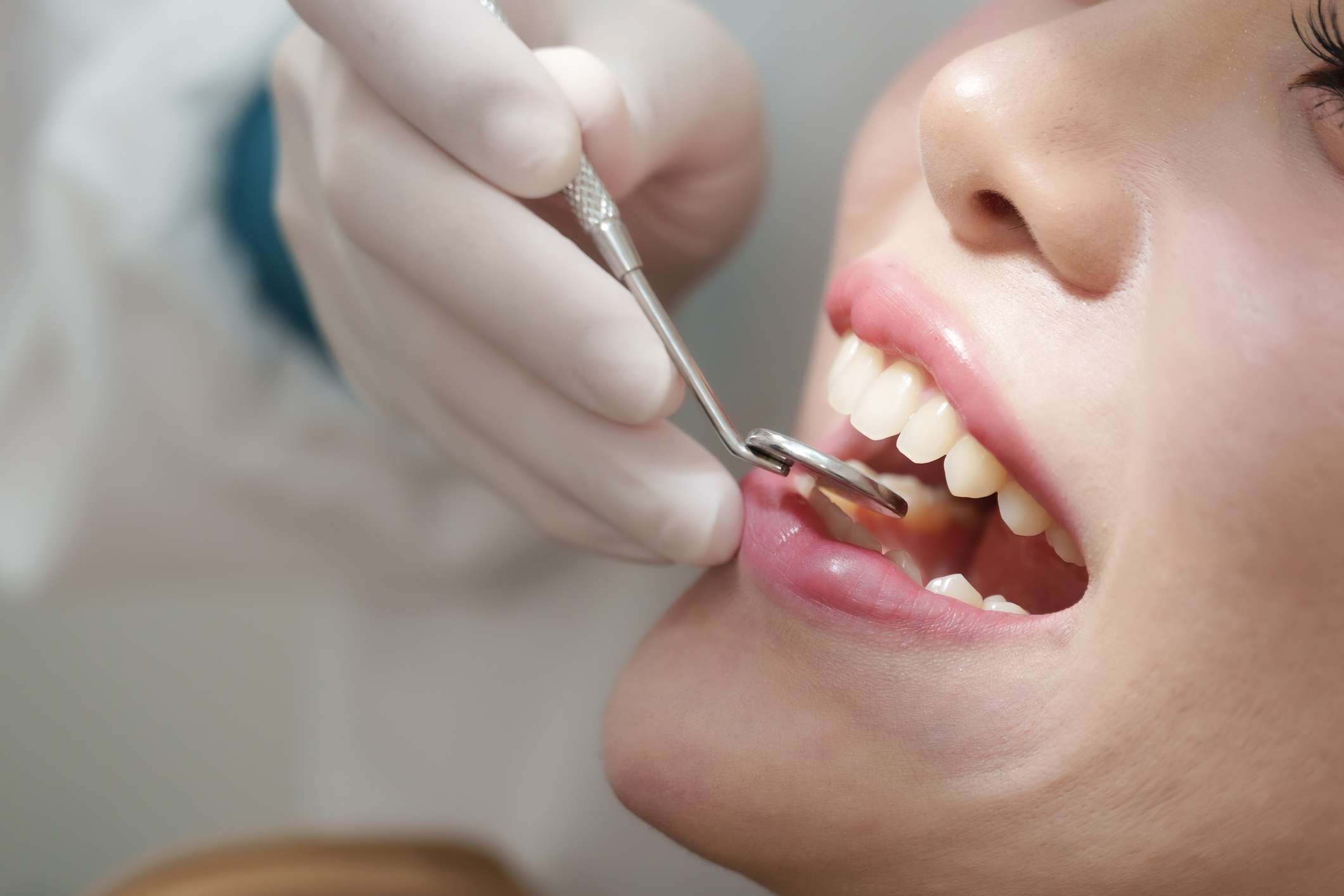 smile-redesigning